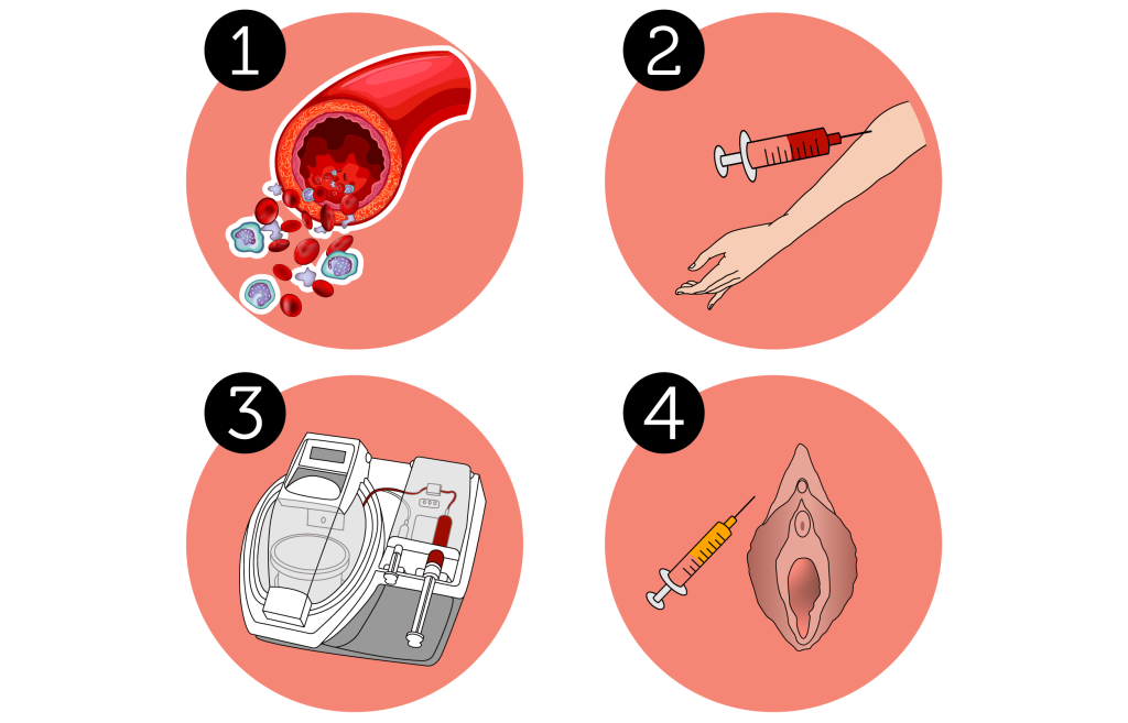 تزریق پی ار پی PRP