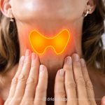 آیا کم کاری تیروئید باعث ناباروری می‌ شود؟