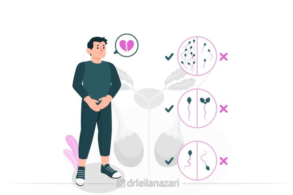 از کجا بفهمیم اسپرم ضعیف است؟