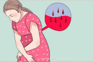 چه خونریزی در بارداری خطرناک است و چه خونریزی در بارداری طبیعی است؟
