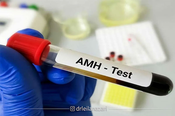 آزمایش هورمون AMH (Anti-Müllerian Hormone)