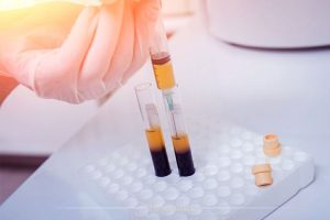 اگزوزوم یا PRP؟ کدام یک برای درمان ناباروری مؤثرتر است؟