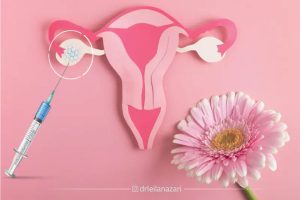 تأثیر تزریق PRP بر افزایش شانس لانه گزینی جنین