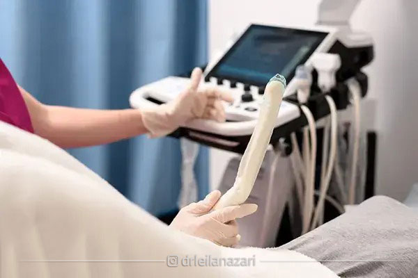 تزریق PRP چگونه انجام می شود؟