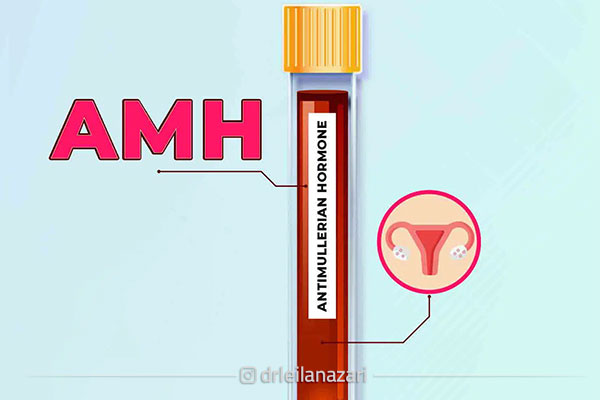 تست های سطح هورمون ضد مولرین (AMH) برای سنجش ذخیره تخمدان