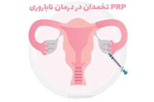 همه‌چیز درباره تزریق PRP برای بهبود عملکرد تخمدان‌ها