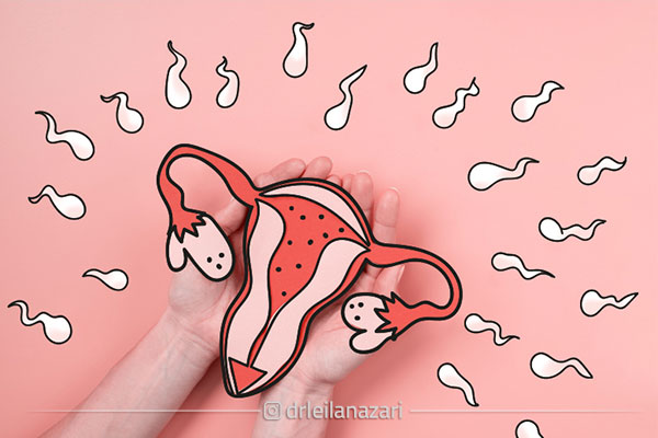 اختلال در تخمک گذاری