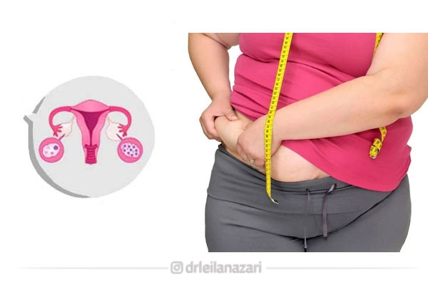 ارتباط چاقی شکمی و تخمک گذاری