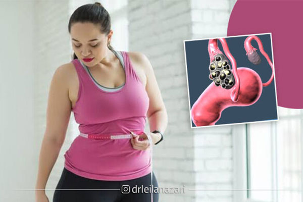 راهکارهای مؤثر برای مدیریت چاقی شکمی و بهبود تخمک گذاری