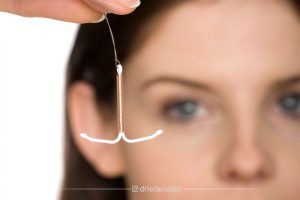 آی یو دی (IUD) چیست؟ معرفی انواع مسی و هورمونی